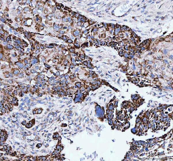 Anti-IARS2 Antibody