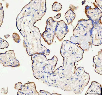 Anti-IARS2 Antibody
