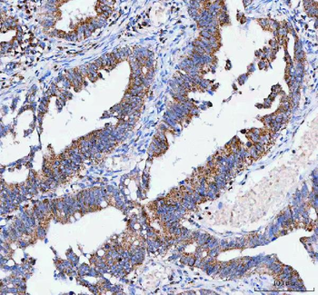 Anti-IARS2 Antibody