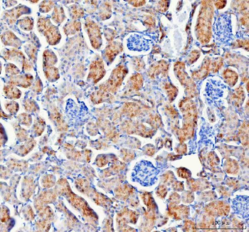 Anti-IARS2 Antibody