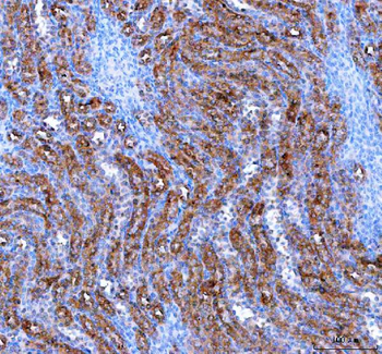 Anti-IARS2 Antibody