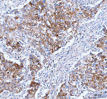 IARS1 Antibody