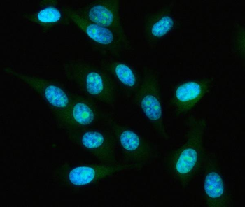 Anti-IAH1 Antibody