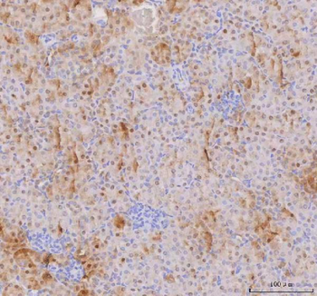 Anti-IAH1 Antibody