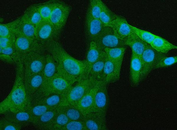 Anti-JCHAIN Antibody