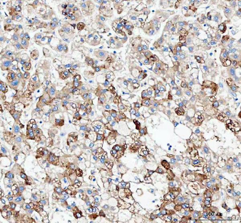 Anti-JCHAIN Antibody