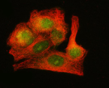 Anti-LZIC Antibody
