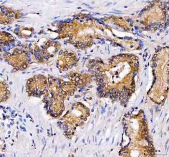 Anti-LZIC Antibody