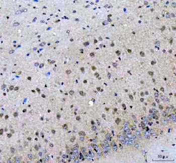 Anti-LZIC Antibody