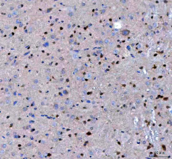Anti-LZIC Antibody