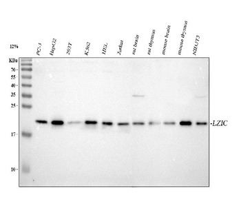 Anti-LZIC Antibody