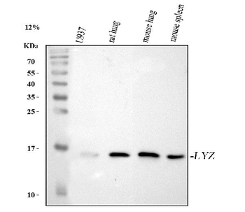 Anti-Lysozyme/LYZ Antibody
