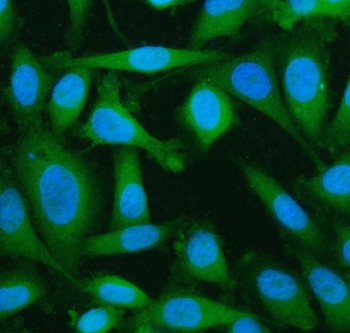 Anti-LYPLA2 Antibody