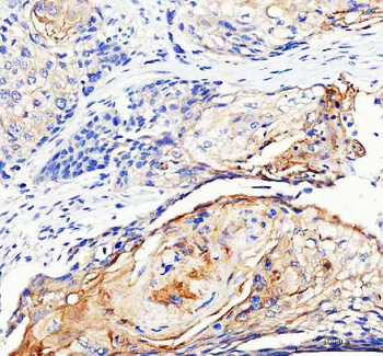 Anti-LYPLA2 Antibody