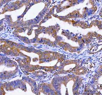 Anti-LYPLA2 Antibody