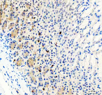 Anti-LYPLA2 Antibody