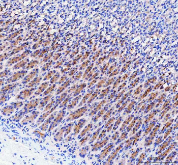 Anti-LYPLA2 Antibody