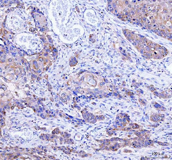 Anti-LYPLA1 Antibody