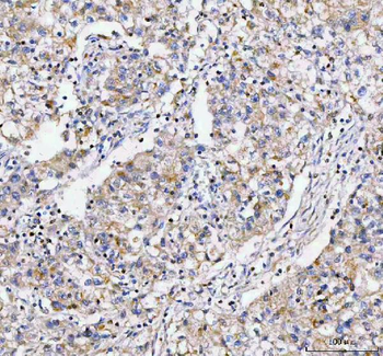 Anti-LYPLA1 Antibody