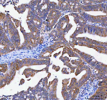 Anti-LYPLA1 Antibody