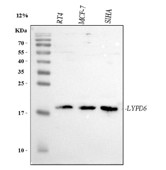 Anti-LYPD6 Antibody
