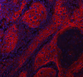 Anti-LYPD3 Antibody