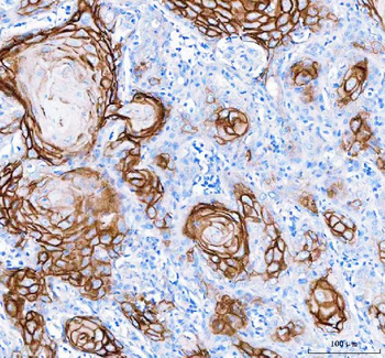 Anti-LYPD3 Antibody