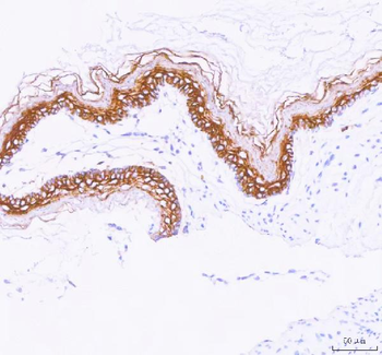 Anti-LYPD3 Antibody