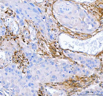 Anti-Lumican/LUM Antibody