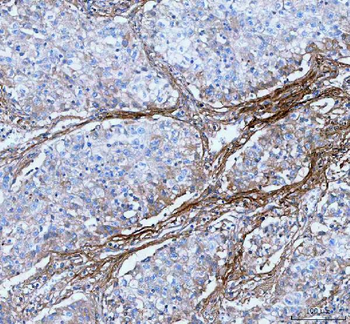 Anti-Lumican/LUM Antibody