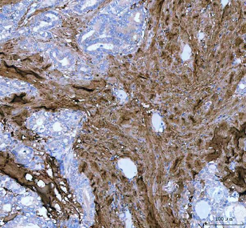 Anti-Lumican/LUM Antibody
