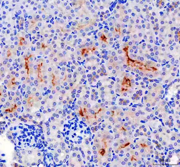 Anti-Lumican/LUM Antibody