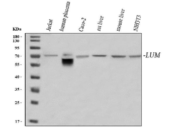 Anti-Lumican/LUM Antibody