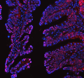 Anti-LTA4H Antibody