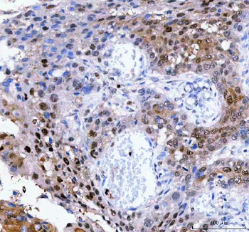 Anti-LTA4H Antibody