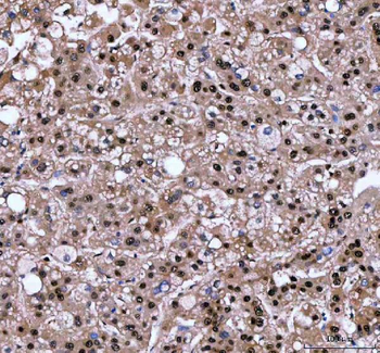 Anti-LTA4H Antibody