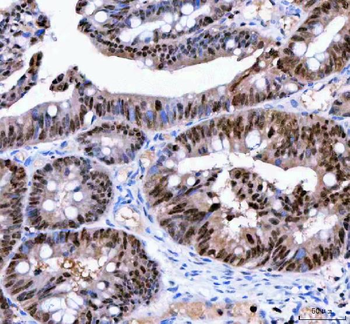 Anti-LTA4H Antibody