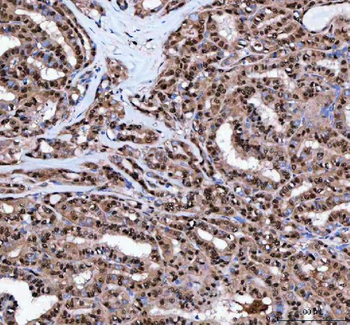 Anti-LTA4H Antibody