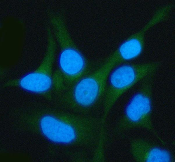 Anti-LSG1 Antibody