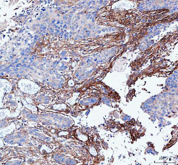 Anti-LSG1 Antibody