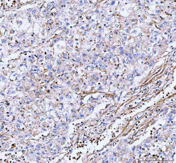 Anti-LSG1 Antibody