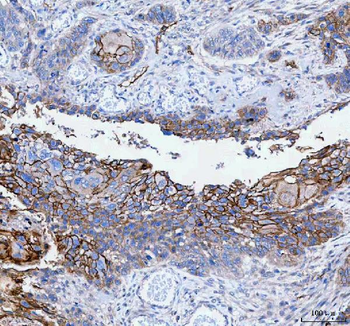 Anti-PALM Antibody