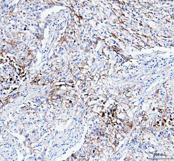 Anti-PALM Antibody