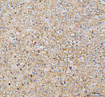 Anti-PALM Antibody