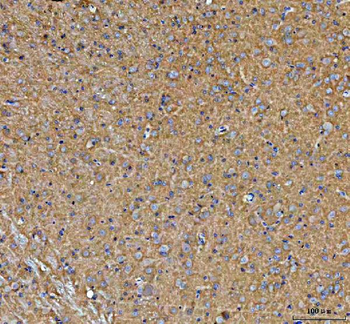 Anti-PALM Antibody