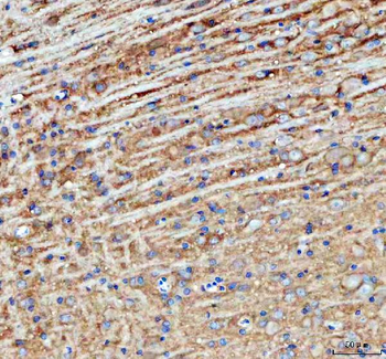 Anti-PALM Antibody