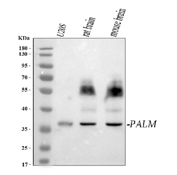 Anti-PALM Antibody