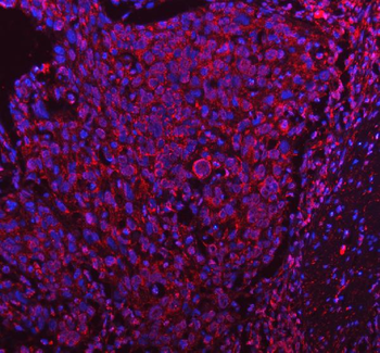 Anti-PDK4 Antibody