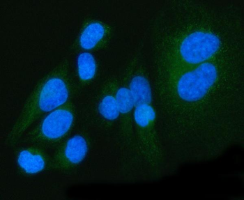 Anti-PDK4 Antibody