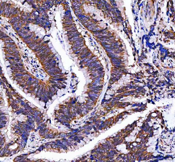 MTF1 Antibody